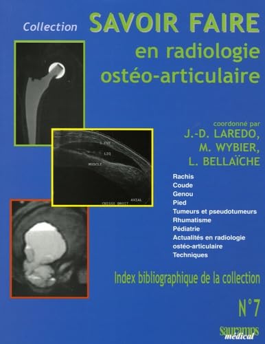 9782840234340: SAVOIR FAIRE EN RADIOLOGIE OSTEO-ARTICULAIRE T7 (7): rachis, coude, genou, pied, tumeurs et pseudotumeurs, rhumatisme, pdiatrie, actualits en radiologie osto-articulaire, techniqu