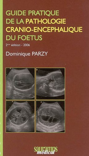 Beispielbild fr Guide pratique de la pathologie crnio-encphalique du foetus zum Verkauf von Ammareal