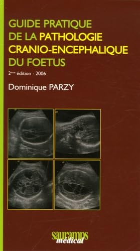 9782840234524: Guide pratique de la pathologie cranio-encphalique du foetus