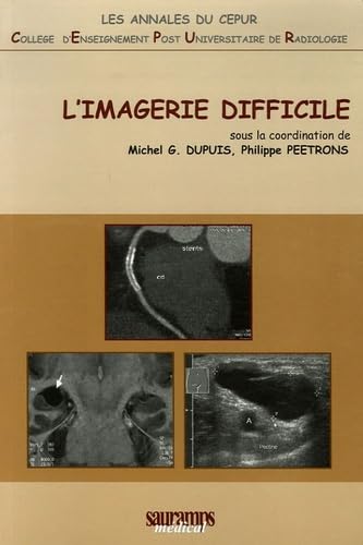 9782840234654: IMAGERIE DIFFICILE CEPUR