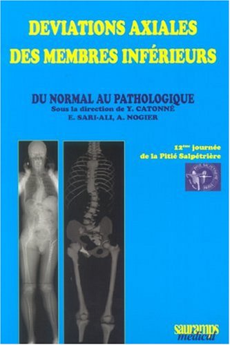 Stock image for Dviations axiales des membres infrieurs : Du normal au pathologique for sale by Ammareal