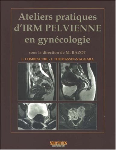 Beispielbild fr Ateliers pratiques d'IRM pelvienne en gyncologie zum Verkauf von medimops