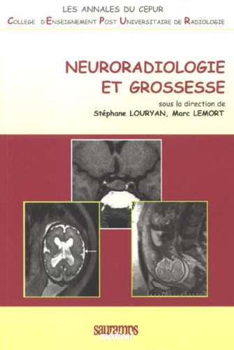 Stock image for NEURORADIOLOGIE ET GROSSESSE for sale by Ammareal