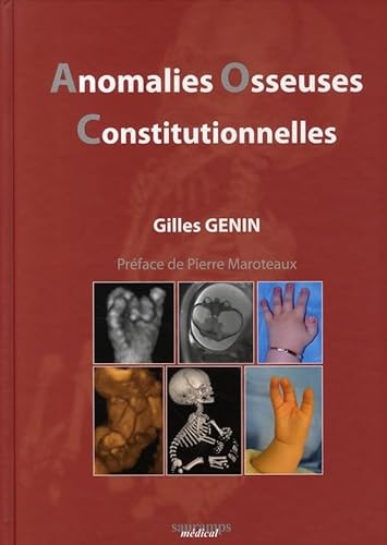 Stock image for Anomalies osseuses consitutionnelles : Dmarche pluridisciplinaire : obsttricale, pdiatrique, gntique, radiologique, gntique, radiologique, chirurgicale et psychologique for sale by Revaluation Books