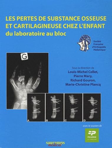 9782840235651: LES PERTES DE SUBSTANCE OSSEUSE ET CARTILAGINEUSE CHEZ L'ENFANT. DU LABORATOIRE: "Du laboratoire au bloc"