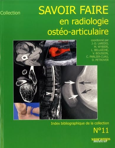 Beispielbild fr Savoir faire en radiologie osto-articulaire. 11. Savoir faire en radiologie osto-articulaire. N 11 zum Verkauf von Chapitre.com : livres et presse ancienne