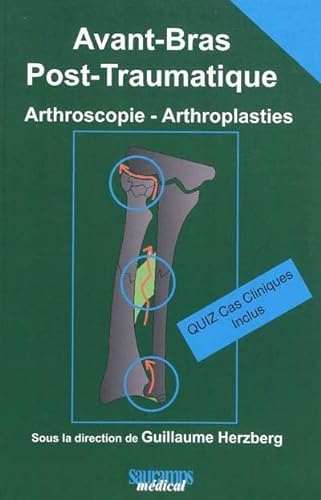 9782840236399: AVANT BRAS POST TRAUMATIQUE: Arthroscopie - Arthroplasties