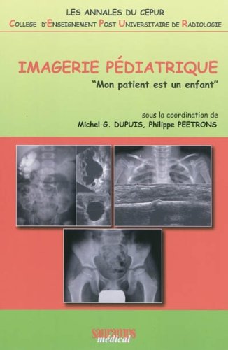 Stock image for L'IMAGERIE PEDIATRIQUE CEPUR for sale by Ammareal