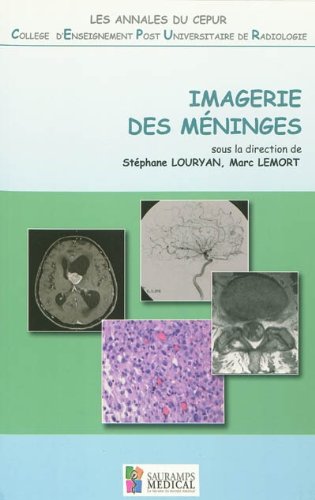 Stock image for IMAGERIE DES MENINGES - ANNALES DU CEPUR for sale by Ammareal