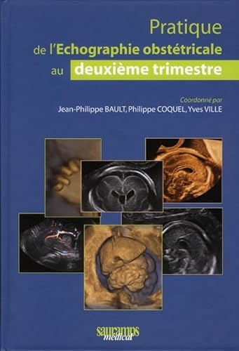 9782840237280: PRATIQUE DE L ECHOGRAPHIE OBSTETRICALE AU 2E TIMESTRE 2E ED