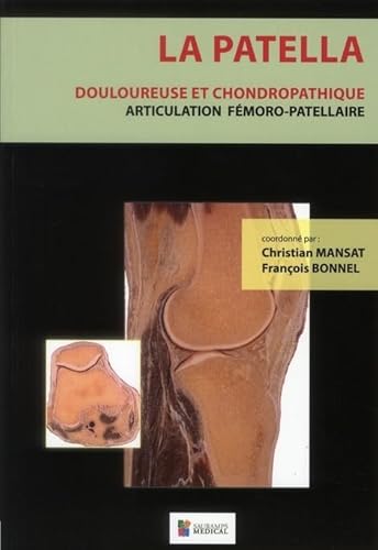 9782840237297: LA PATELLA: articulation fmoro-patellaire