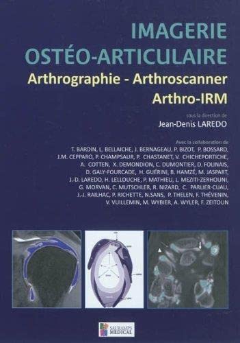 9782840237433: IMAGERIE OSTEO-ARTICULAIRE-ARTHROGRAPHIE,ARTHROSCANNER,ARTHRO-IRM