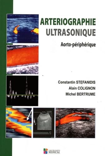 9782840237488: Arteriographie ultrasonique: Aorto-priphrique
