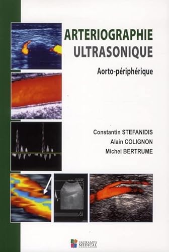 Stock image for ARTERIOGRAPHIE ULTRASONIQUE for sale by Gallix