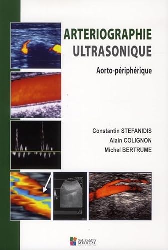 9782840237488: ARTERIOGRAPHIE ULTRASONIQUE: Aorto-priphrique