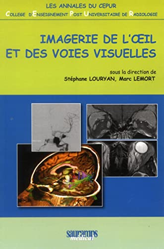 Stock image for IMAGERIE DE L'OEIL ET DES VOIES VISUELLES LEMORT/LOURYAN; Lemort, Marc et Louryan, Stphane for sale by BIBLIO-NET