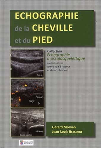 Beispielbild fr ECHOGRAPHIE DE LA CHEVILLE ET DU PIED zum Verkauf von Gallix