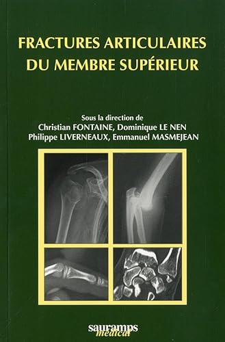 Stock image for Fractures articulaires du membre suprieur for sale by medimops