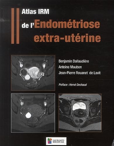 9782840238898: ATLAS IRM DE L'ENDOMETRIOSE EXTRA-UTERINE