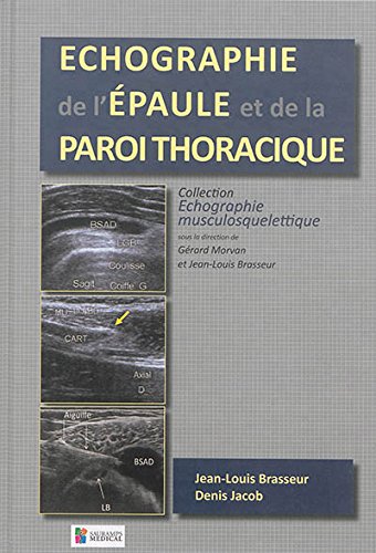 Beispielbild fr ECHOGRAPHIE DE L'EPAULE ET DE LA PAROI THORACIQUE zum Verkauf von Gallix