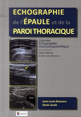 9782840239161: ECHOGRAPHIE DE L'EPAULE ET DE LA PAROI THORACIQUE