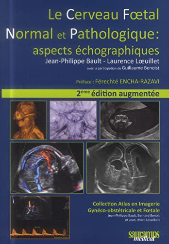 9782840239239: Le cerveau foetal normal et pathologique : aspects chographiques: 0000