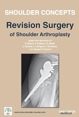 Stock image for SHOULDER CONCEPTS - REVISION SURGERY OF SHOULDER ARTHROPLASTY 2014 for sale by Gallix