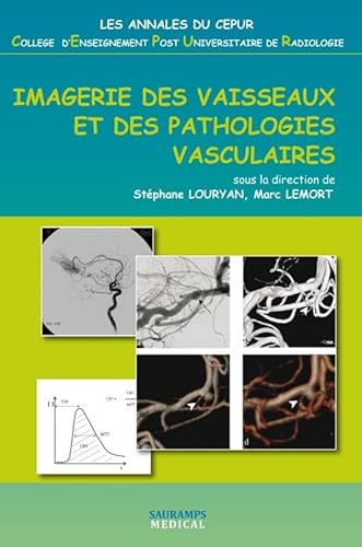 Stock image for IMAGERIE DES VAISSEAUX ET DES PATHOLOGIES VASCULAIRES for sale by Ammareal