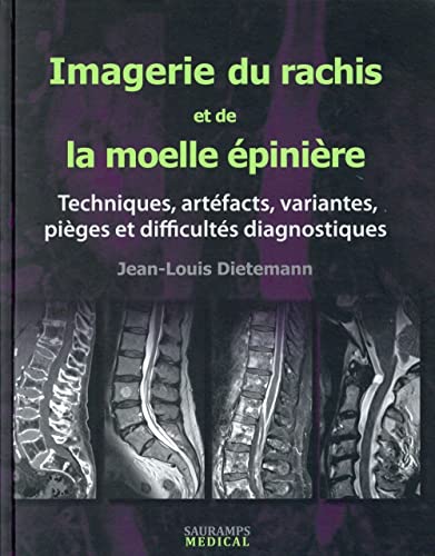 9782840239673: IMAGERIE DU RACHIS ET DE LA MOELLE EPINIERE: Techniques, artfacts, variantes, piges et difficults diagnostiques