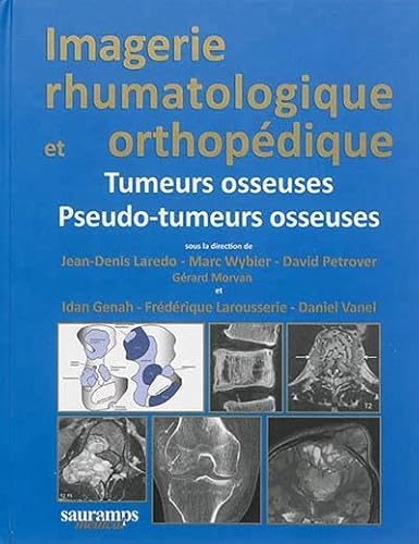 Stock image for Imagerie rhumatologique et orthopdique - Tome 4 : Tumeurs osseuses ; Pseudo-tumeurs osseuses for sale by D'un livre  l'autre