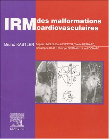 Stock image for IRM des malformations cardiovasculaires for sale by Ammareal