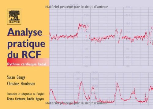 Beispielbild fr Analyse pratique du RCF : Rythme cardiaque foetal zum Verkauf von medimops