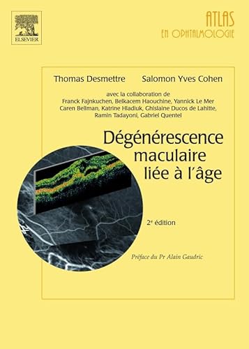 Stock image for Degenerescence maculaire liee a l'age (2e edition) for sale by LiLi - La Libert des Livres
