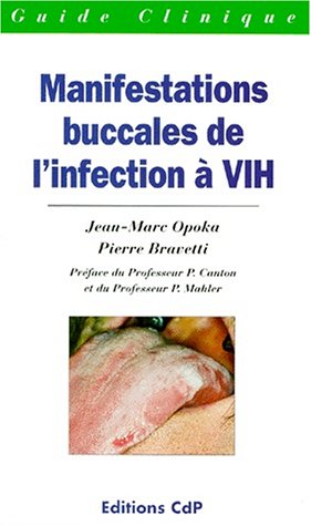 Stock image for Manifestations buccales de l'infection a VIH for sale by Ammareal