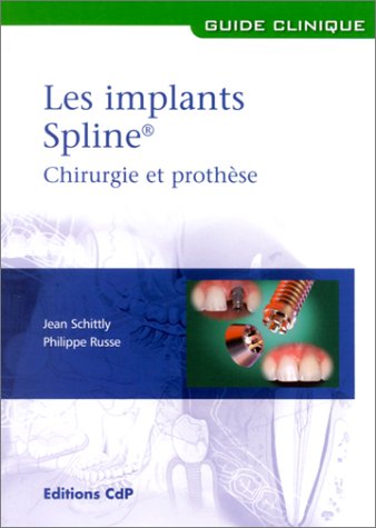 Stock image for Les Implants Spline : Chirurgie et prothse for sale by Ammareal