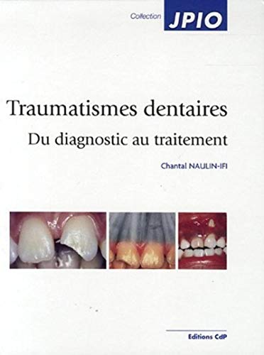 9782843610899: Traumatismes dentaires : Du diagnostic au traitement