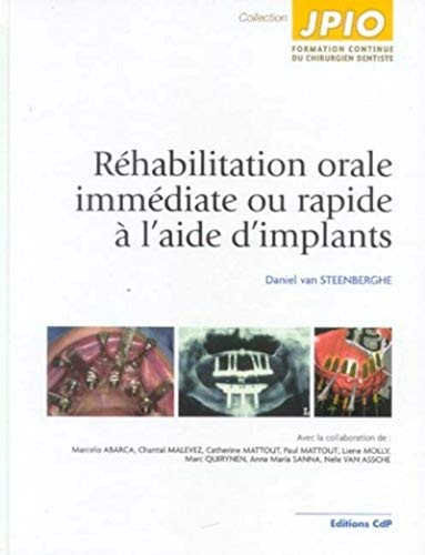 9782843610981: Rhabilitation orale immdiate ou rapide  l'aide d'implants