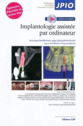 Stock image for Implantologie assiste par ordinateur for sale by Revaluation Books