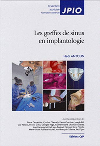 9782843611759: Les greffes de sinus en implantologie