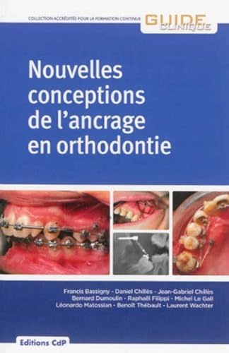 9782843612138: Nouvelles conceptions de l'ancrage en orthodontie