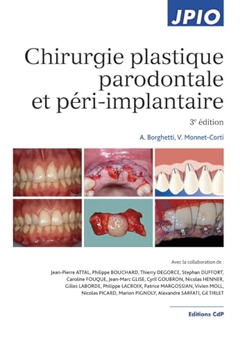 9782843613210: Chirurgie plastique parodontale et pri-implantaire