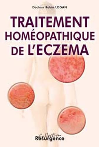 9782872110520: Traitement Homeopathique De L'Eczema