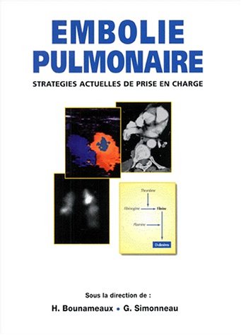Stock image for EMBOLIE PULMONAIRE. : Stratgies actuelles de prise en charge for sale by Ammareal