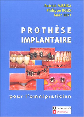 Imagen de archivo de Prothse implantaire pour l'omnipraticien a la venta por Ammareal