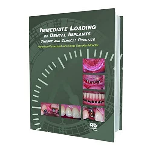 Stock image for Immediate Loading of Dental Implants: Theory and Clinical Practice for sale by GF Books, Inc.