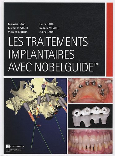 9782912550620: Les traitements implantaires avec Nobelguide