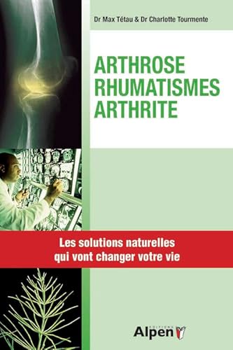 Beispielbild fr Arthrose-rhumathimes-arthrite zum Verkauf von Ammareal