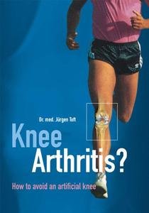 Imagen de archivo de Knee Arthritis? How to Avoid an Artificial Knee a la venta por ThriftBooks-Atlanta