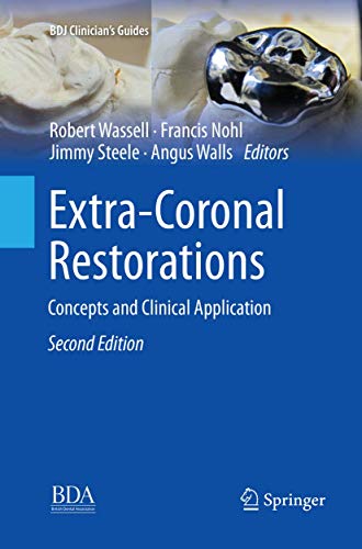 Stock image for EXTRA CORONAL RESTORATIONS CONCEPTS AND CLINICAL APPLICATIONS 2ED (PB 2019) for sale by Books Puddle