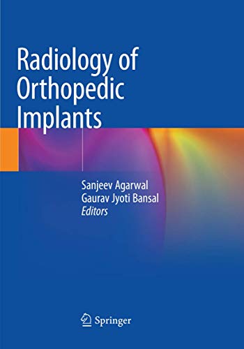 9783030093785: Radiology of Orthopedic Implants